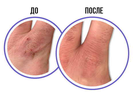 до и после до и после
